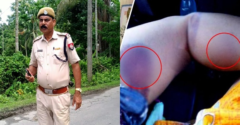 पुलिस है या जल्लाद! असमी बहनों के प्रताड़ना की दिल दहला देने वाली तस्वीरें सोशल मीडिया पर हुईं वायरल
