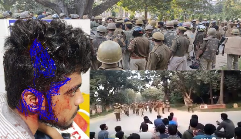 बीएचयू में धरना दे रहे छात्रों पर पुलिस का भीषण लाठीचार्ज