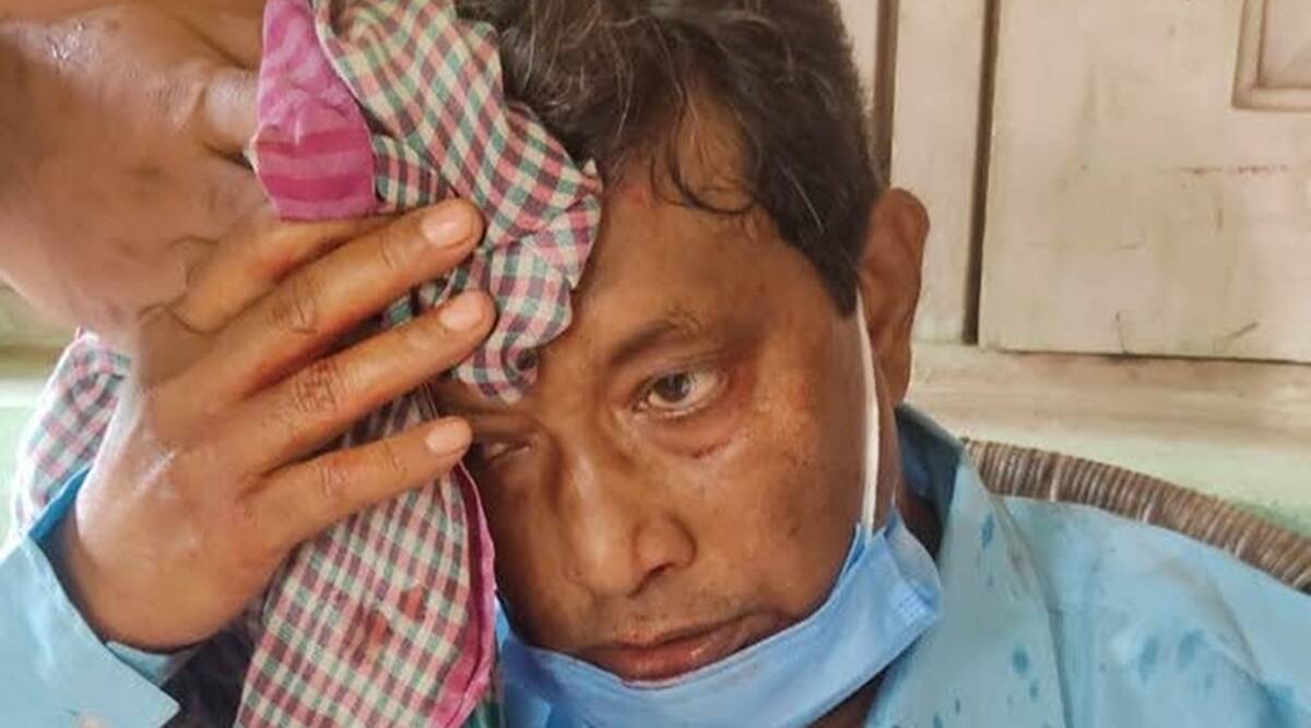 त्रिपुरा में माकपा कार्यकर्ताओं पर बीजेपी संरक्षित गुंडों का हमला, एमएलए समेत 28 लोग घायल