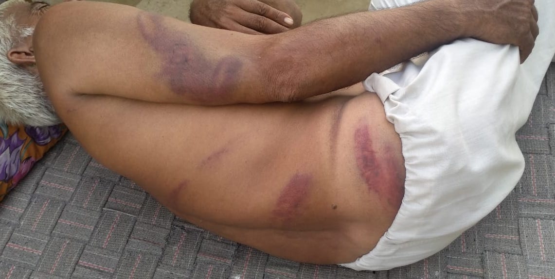 हरियाणा के खेदड़ में पुलिस का भयंकर लाठीचार्ज, कई किसान गंभीर रूप से घायल