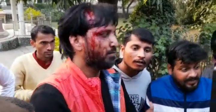 केवाईसी के लिये इविवि कैंपस गये पूर्व छात्र नेता पर सुरक्षा गार्डों ने किया जानलेवा हमला 2 au