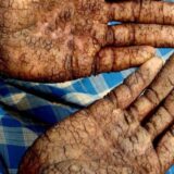बिहार के भू-जल में खतरनाक पदार्थों की व्यापक मात्रा, बढ़ी जानलेवा बीमारियों की आशंका