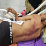 बनारस में दशाश्वमेध घाट पर कलंकित हुआ इंसाफ जब लहूलुहान किशोर रेहान से जवाब-तलब करने लगी व्यवस्था, फर्जी ढंग से बना दिया मुल्जिम !