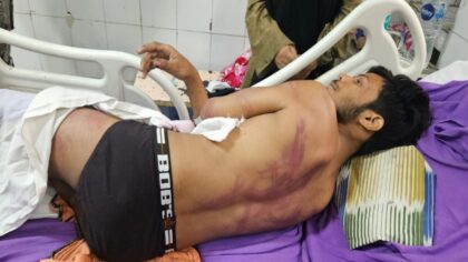 बनारस में दशाश्वमेध घाट पर कलंकित हुआ इंसाफ जब लहूलुहान किशोर रेहान से जवाब-तलब करने लगी व्यवस्था, फर्जी ढंग से बना दिया मुल्जिम !